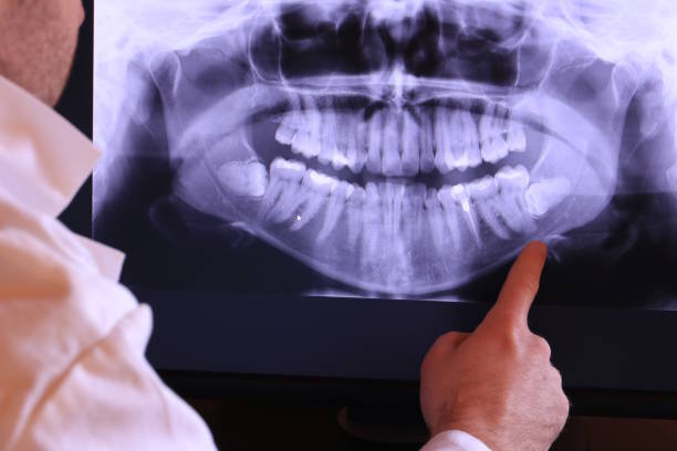 Best Weekend Emergency Dentist in Phoenix Lake, CA
