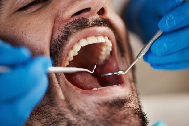 Best Pediatric Emergency Dentist in Phoenix Lake, CA